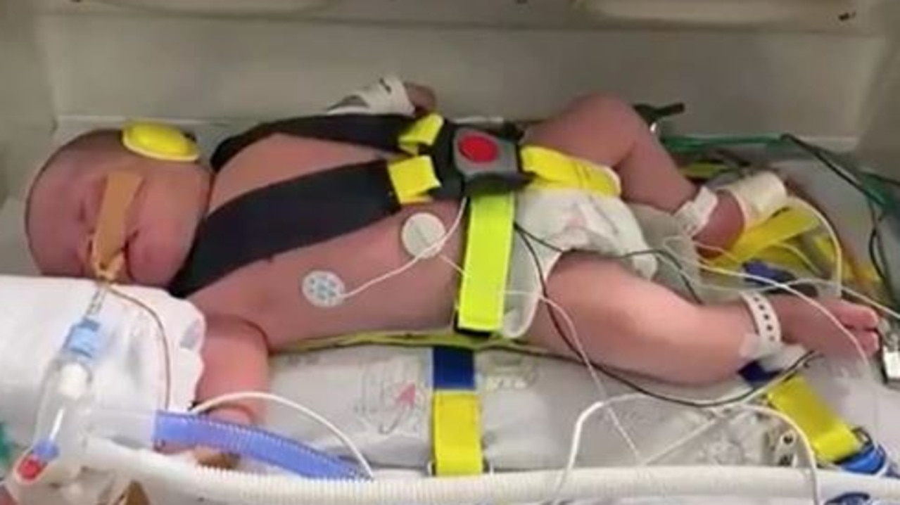 A newborn baby receiving lifesaving treatment in Brisbane has been separated from his parents due to coronavirus border restrictions. Source: 7 News