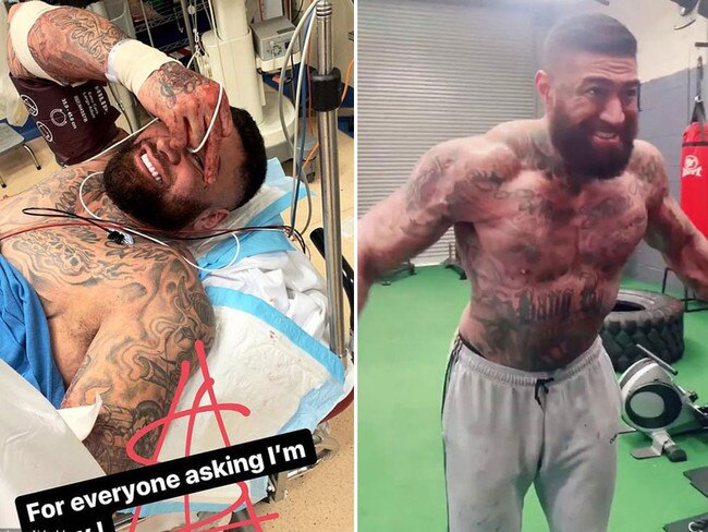 Big Kash on a stretcher at hospital after being shot, left, and now in a TikTok chronicling his workout regime. Pictures: Supplied