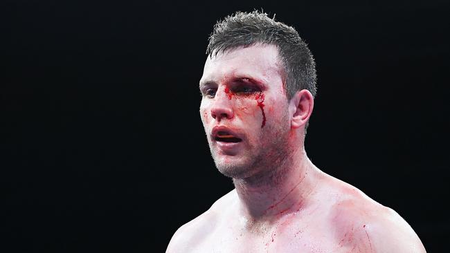 Jeff Horn suffered a deep cut above the left eye. Picture: Getty Images