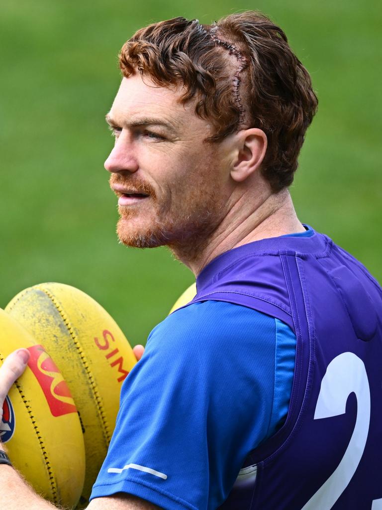 America loses it over photo of Gary Rohan’s fractured skull scar, Geelong Cats AFL news