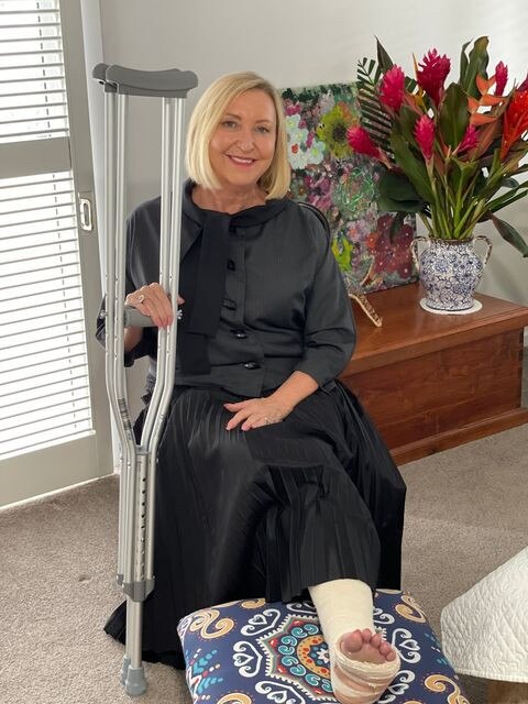 NT Administrator Vicki O'Halloran has broken her leg. Picture: Facebook