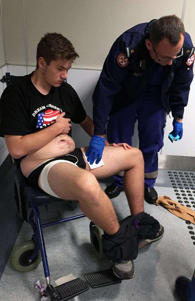 Rhett Butler, then 16, being treated for burns following the May 3, 2015 incident. Picture: AAP/Shine Lawyers