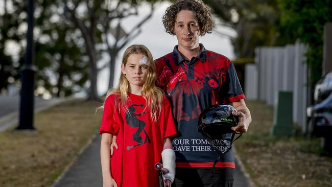 Doctors say Pacific Pines High School students Chloe Uttley may have suffered life-threatening injuries if she wasn’t wearing a helmet when she had a high speed scooter accident. Picture: Jerad Williams