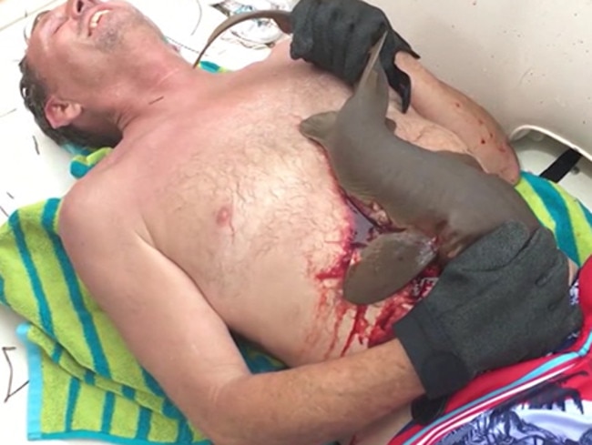 Mr Maccarty swears in pain as the bloodied shark keeps its hold. Picture: Newsflare/AP