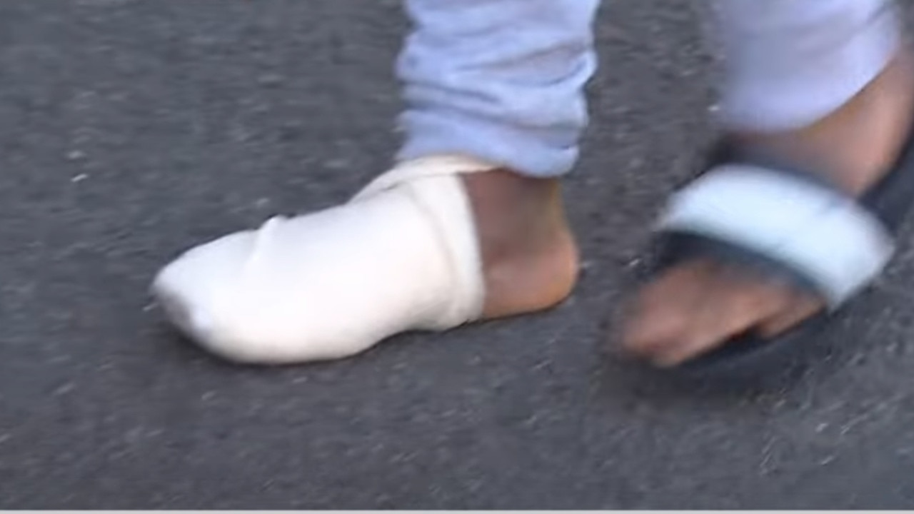 He sustained cuts to his foot while trying to defend himself. Picture: 7News