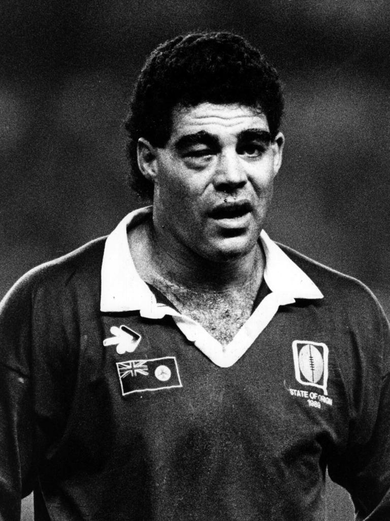 Mal Meninga looking worse for wear after the 1989 Origin decider.