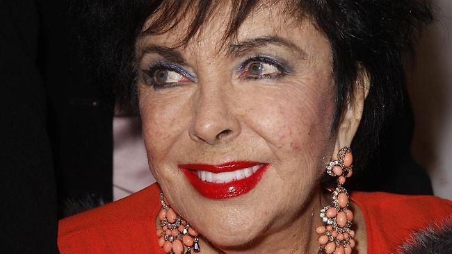 Liz Taylor greatly improved after scare | news.com.au — Australia’s ...