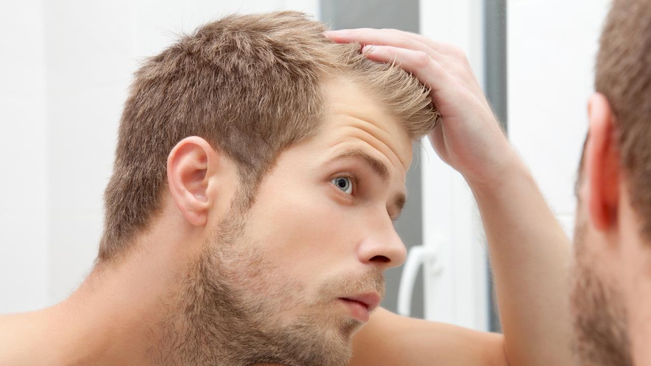 Almost half of men experience hair loss.