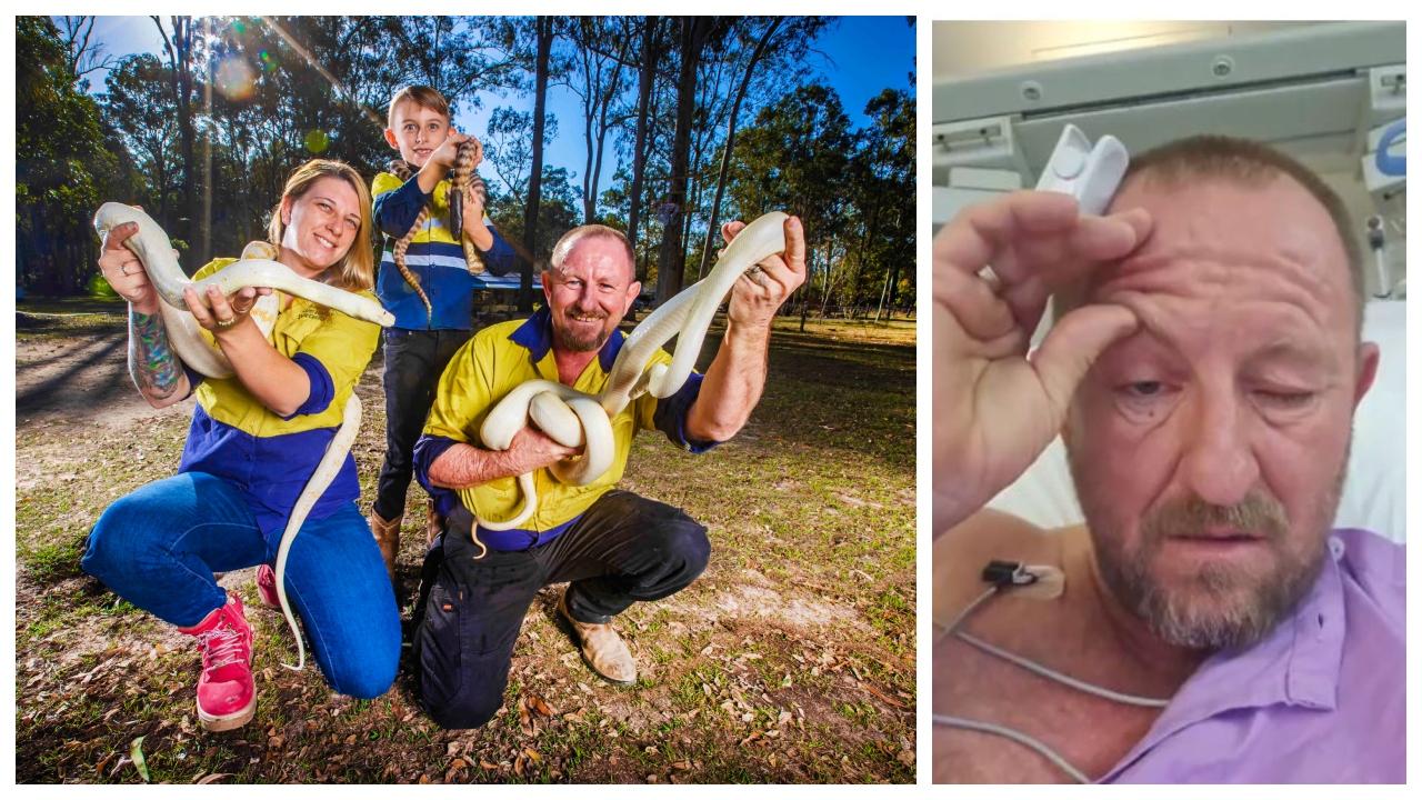 ‘Slowly Improving’: Snake Catcher Still In Hospital Four Days After ...