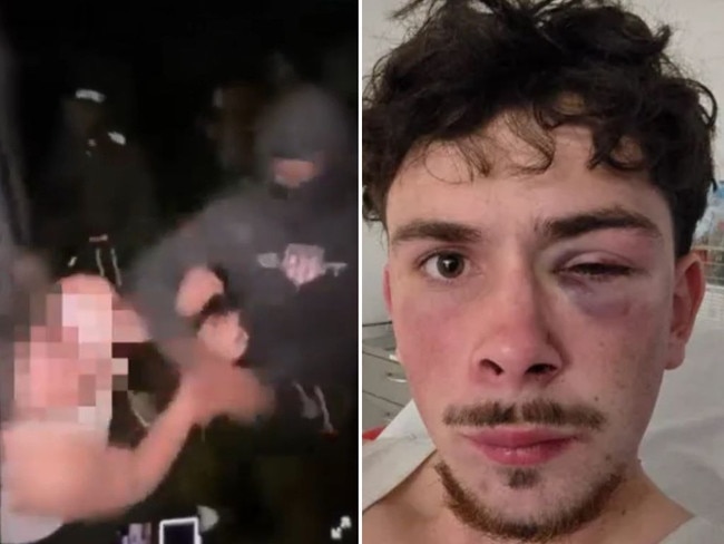 The mother of a young man who was bashed by a group of thugs at a party say people are “afraid to speak out”. Warning: Graphic