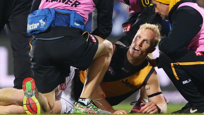 Steven Morris of the Tigers reacts after he suffers a leg injury