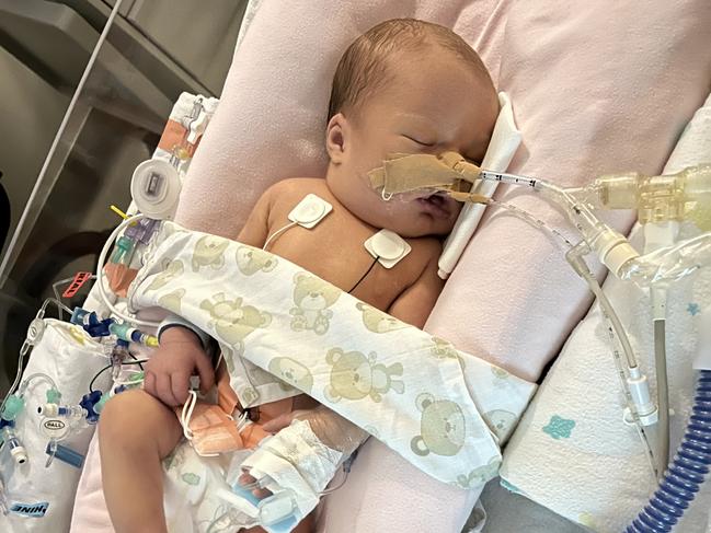 Georgie Campbell was born with a rare congenital heart defect, and was nearly one of four babies who die from the condition each week. Photo: Contributed