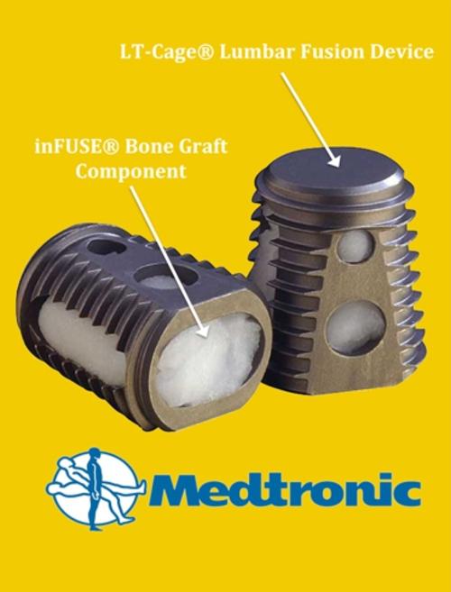 Up to 40,000 Australians could be at risk of adverse events from the off label use of a Medtronic bone graft product. Picture: Supplied