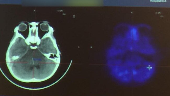 Images from an MRI scan show detail of a human brain.