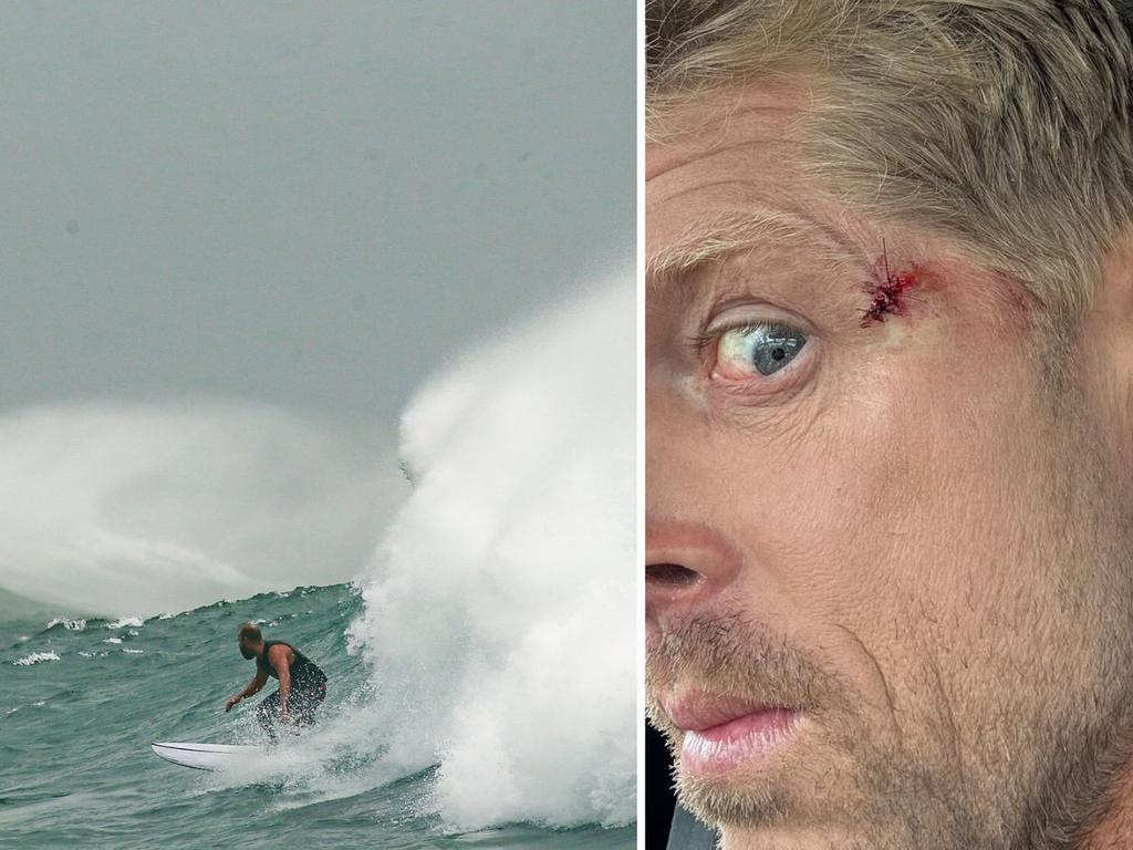 Mick Fanning in the surf and showing off his injury on Instagram.