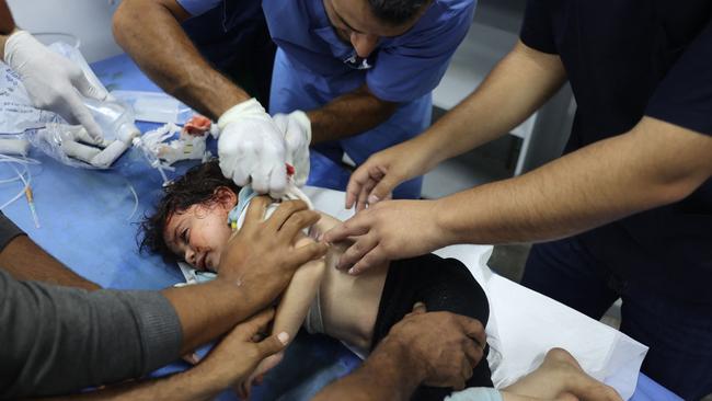 A Palestinian girl, wounded in an Israeli strike on a camp for displaced Gazans, receives treatment at a hospital in Rafah on May 26, 2024, amid the ongoing conflict between Israel and the militant group Hamas. (Photo by Eyad BABA / AFP)