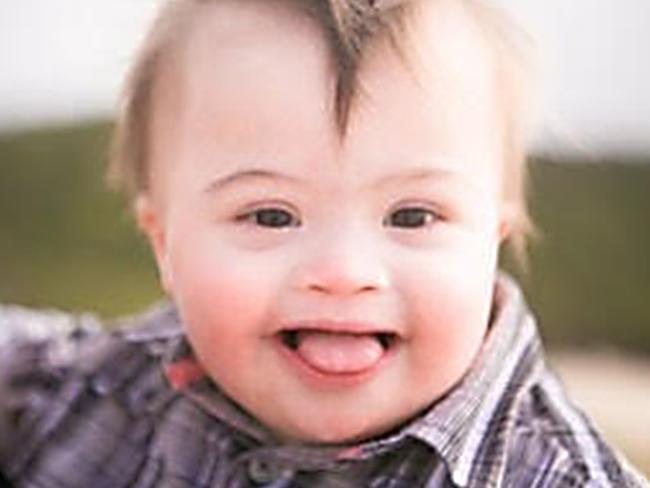 Nationwide advocacy group Meningococcal Australia is ‘deeply concerned’ about the new figures. Picture: Facebook