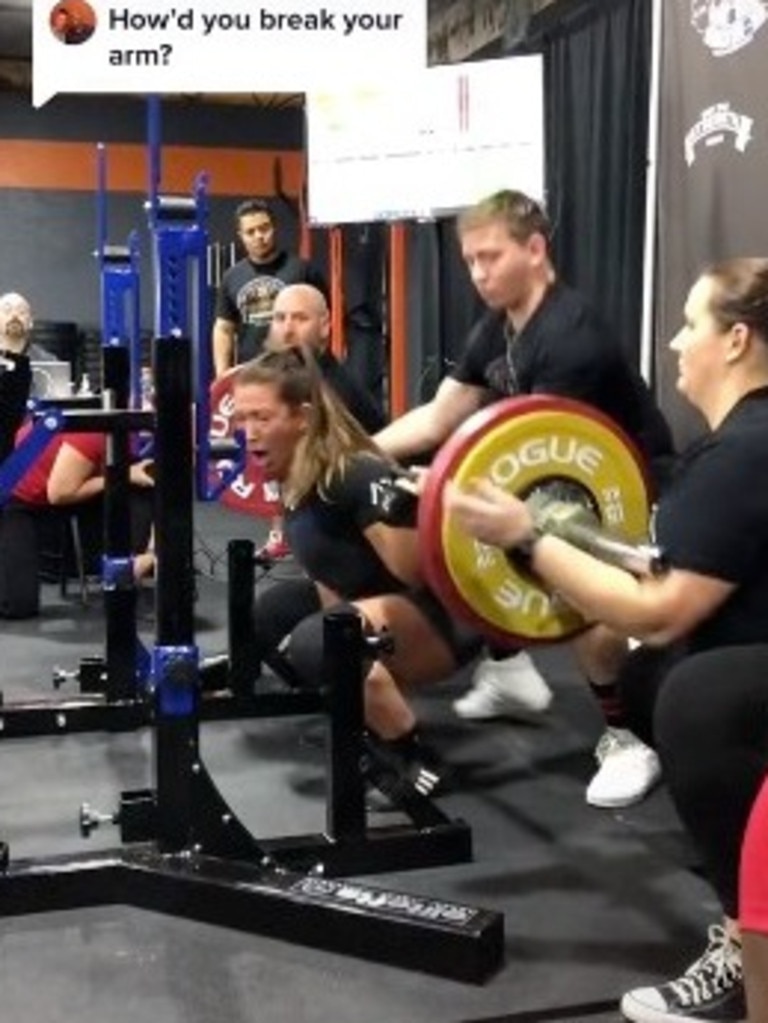 Power lifter arm snap video: Robyn Machado Instagram broken bone | news ...