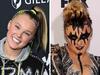 JoJo Siwa reveals $75k cosmetic surgery