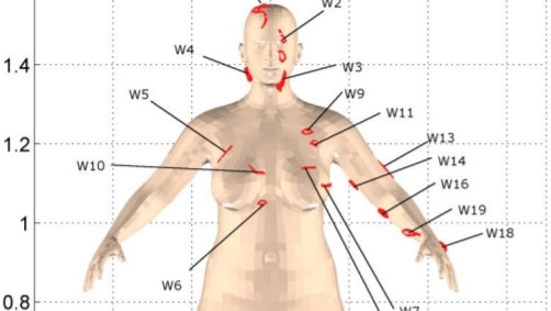 Images of the location of Blackburn’s wounds, from a report for police by biomechanics expert Zac Couper.