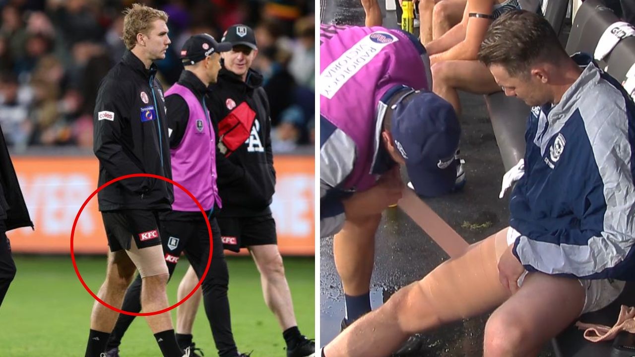 ‘Unprecedented’ injury toll stuns AFL world