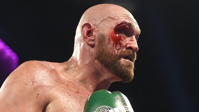 Should Tyson Fury be in discussions for best heavyweight of all time?