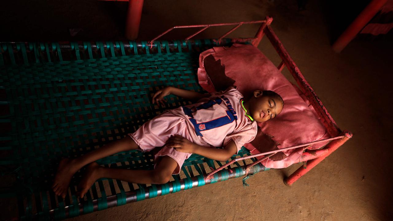 The four-year-old son of Awadya Ahmed, born blind and crippled, a handicap that she blames on a large mound of gold mining waste left near her house, lies in a bed in her home in the village of Banat in River Nile state, north of the Sudanese capital Khartoum, on June 6, 2022. - Exposure to mercury, used to extract gold, poses particular risk to the nervous, digestive and immune systems, and could be fatal, according to the World Health Organisation. It also threatens the development of children in the womb and early in life, the WHO said. But mining remains a source of fast profits and attracts many living in dire conditions in Sudan, one of the world's poorest countries. (Photo by ASHRAF SHAZLY / AFP)