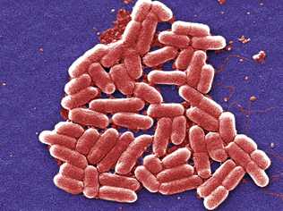 FILE PHOTO: E. Coli bacteria. . Picture: Janice Carr