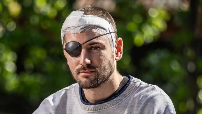 Injured St Kevin's Old Boys footballer MICHAEL PISKER who was hurt in a VAFA match in July. He has lost sight in his right eye but apart from that he is making a strong recovery. Picture: Jake Nowakowski