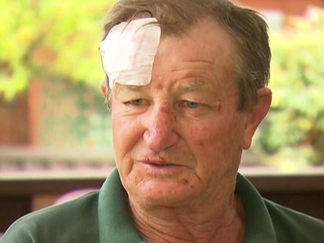 Norm described his attackers as ‘scumbags’. Picture: Channel 7