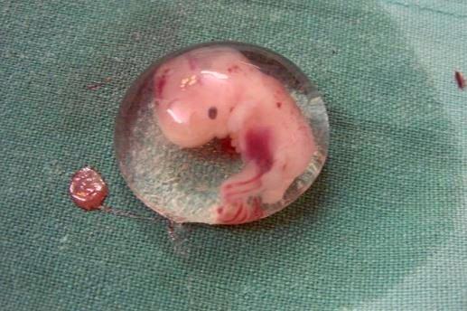 A human embryo at six weeks. Picture: Pinkterest