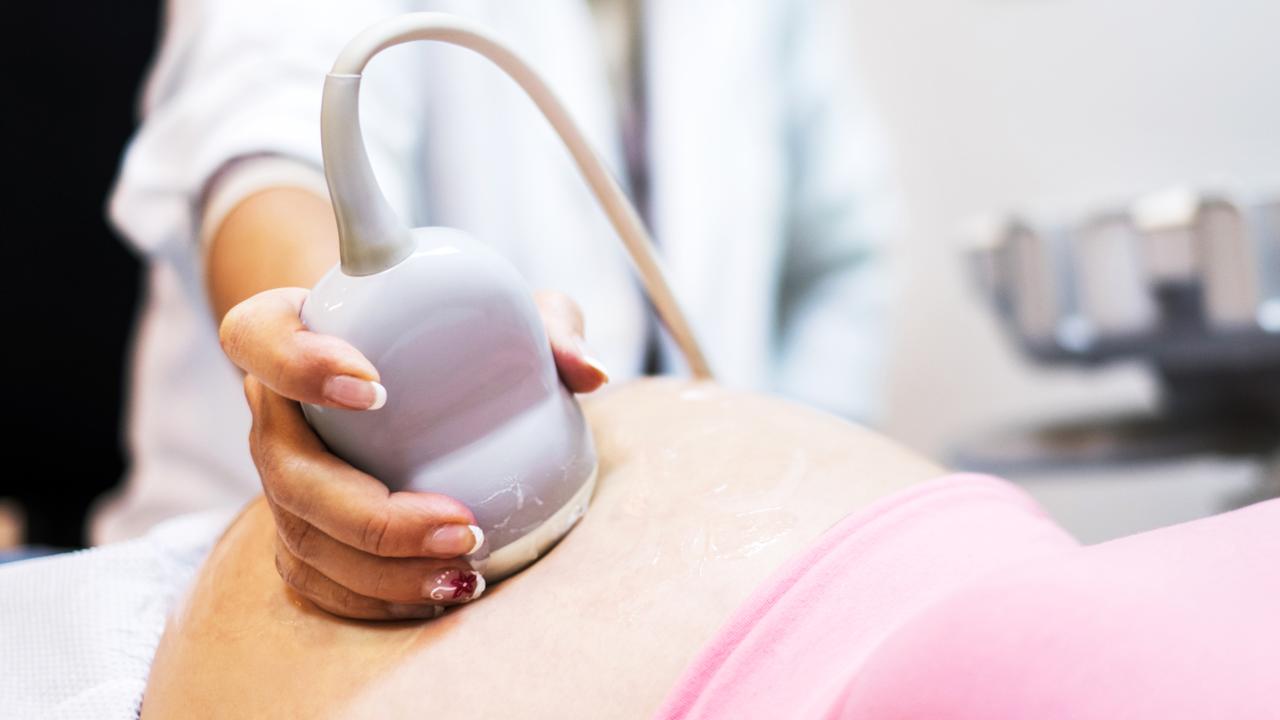 Gynaecologist using ultrasound on pregnant woman. Picture: istock