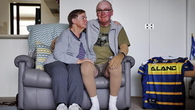 Parramatta fan and volcano eruption survivor John Cozad pictured at home today in Swansea with wife Beverley. John will watch Parramatta Eels play for the first time since the eruption live this Friday. Picture: Sam Ruttyn