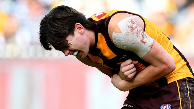 MELBOURNE, AUSTRALIA - AUGUST 18: Will Day of the Hawks receives medical attention during the round 23 AFL match between Hawthorn Hawks and Richmond Tigers at Melbourne Cricket Ground, on August 18, 2024, in Melbourne, Australia. (Photo by Josh Chadwick/AFL Photos/via Getty Images)