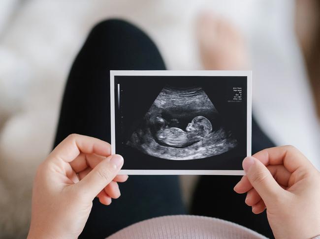 fertility xx x Picture: iStock