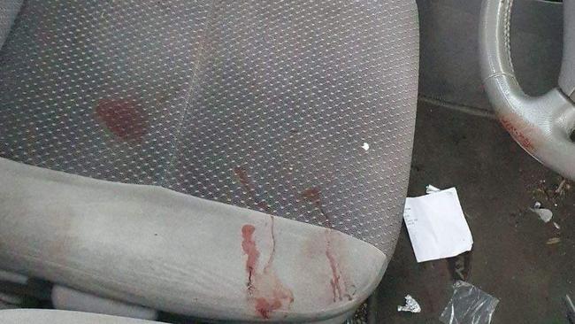 Blood spattered in a car belonging to the victim of the alleged stabbing in Berwick.