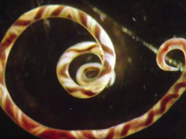 Rat lungworm cases have broken out in Hawaii.