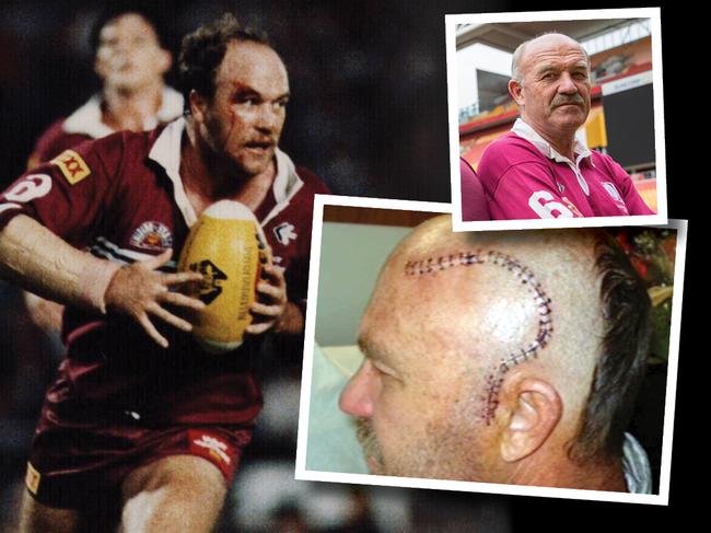 Art for Wally Lewis yarn