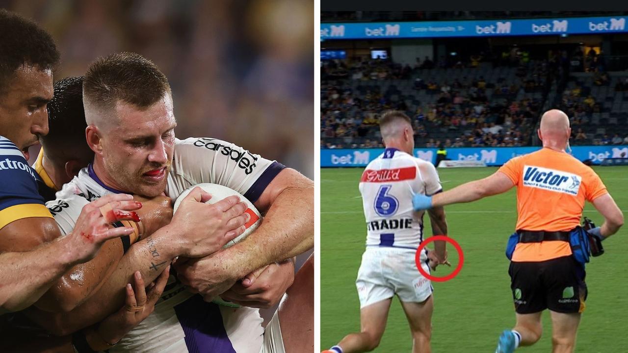 Cameron Munster played through the pain. Photo: Getty Images and Fox League