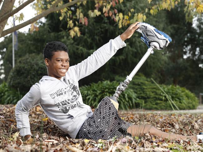 HOLD FOR THE HERALD SUN PIC DESK. Xavier Mahavelo, from Madagascar, has a new prosthetic leg after having his leg amputated during surgery. Xavier recovers well at the Children First Retreat in Kilmore.  Picture: Alex Coppel.