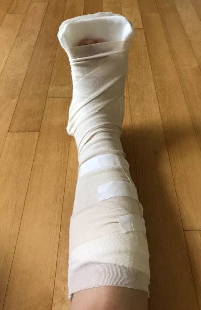 Leena Son's holiday to South Korea was ruined after she needed hospital treatment for a fractured ankle on a Korean Air flight. Picture: Supplied/New Zealand Herald.
