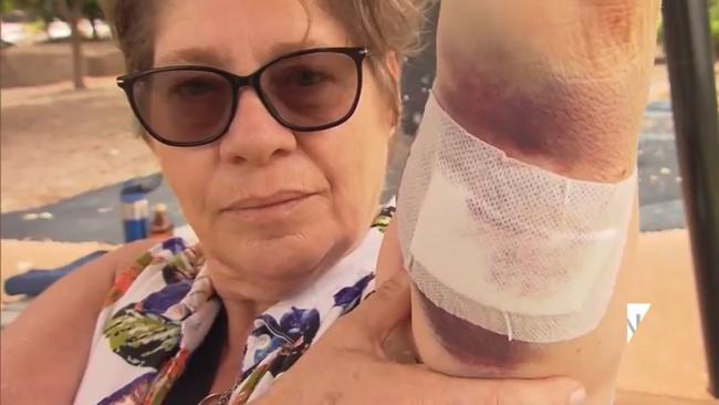 Lea Hockley was walking with her dog at Munno Para when the attack occurred. Picture: 7 News