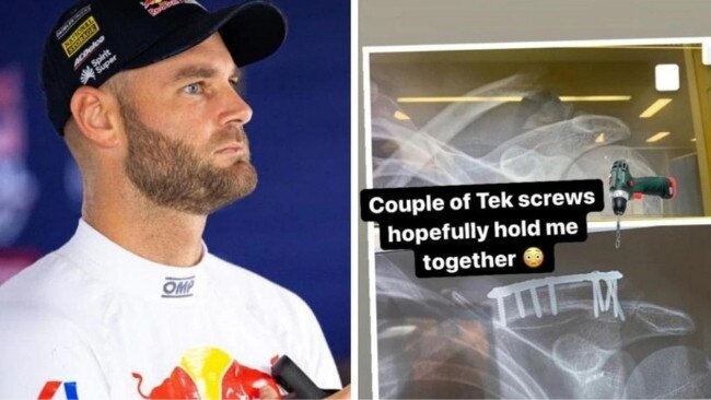 Shane van Gisbergen’s social media post revealing he needed nine screws to hold his shoulder together.