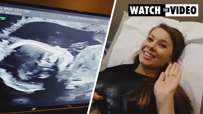 Bindi Irwin shares intimate video from pregnancy ultrasound