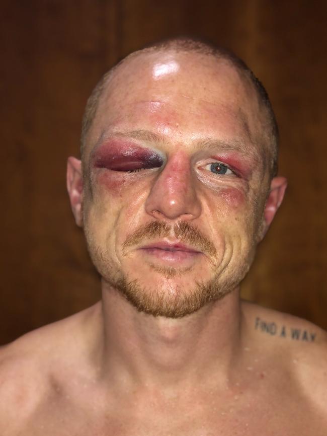 Luke Jackson looking battered and bruised after the brave Tasmanian was stopped in the ninth round of his WBO featherweight world title fight against Northern Ireland’s Carl Frampton in Belfast yesterday. Picture: SUPPLIED