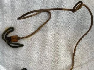 Doctors removed both a charging cable and hair tie from the boy’s internal organs. @prof.dr.yasardogan