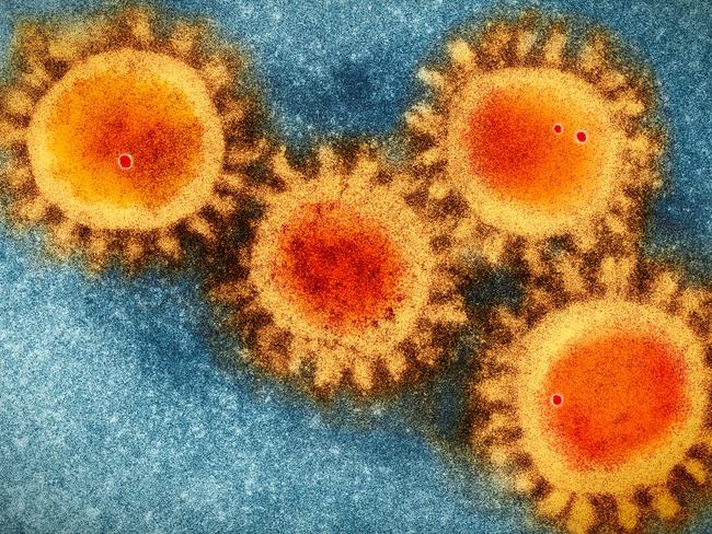 Colored visualisation of electron microscopy photo of the coronavirus  COVID-19