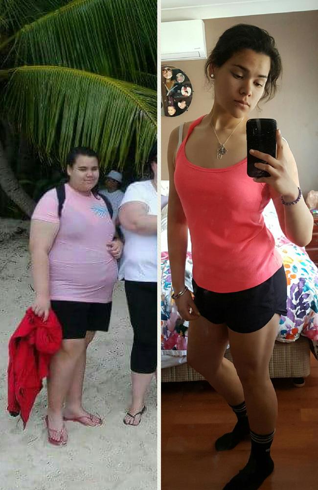 16-year-old-sydney-teenager-unrecognisable-after-65kg-weight-loss