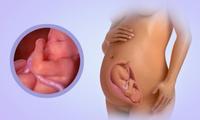 31 Weeks Pregnant- Symptoms and birth preparations