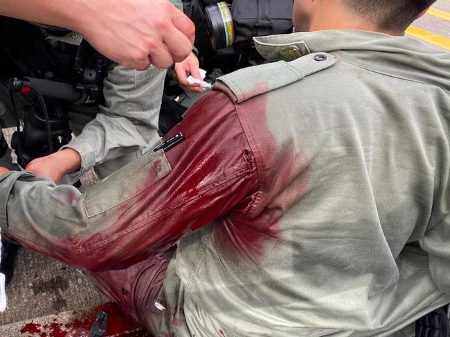 The blood-soaked arm of the Hong Kong police officer who was allegedly stabbed by a protester. Picture: Twitter/@hkpoliceforce